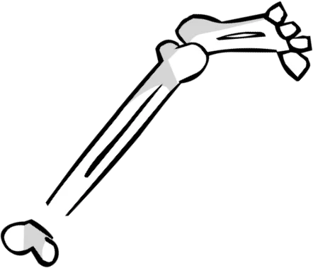 Image credit url: Bone Leg Image
